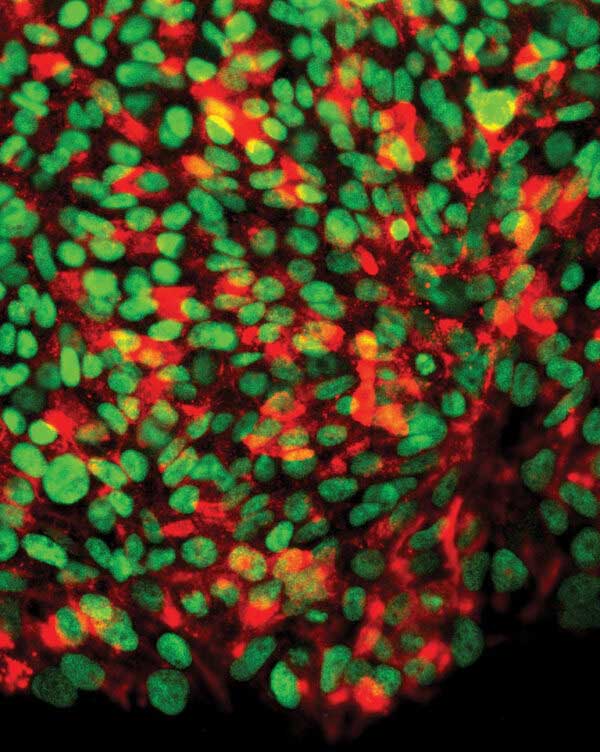 Microscopic image of human induced pluripotent stem cells